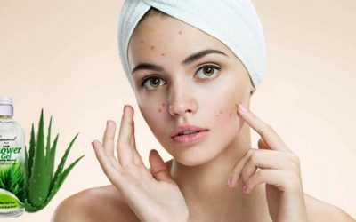 Simply 4 Steps How To Treat Acne