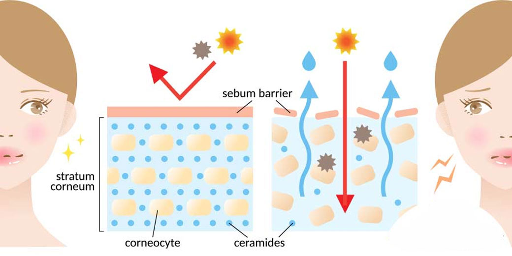 manfaat ceramide untuk merawat kulit